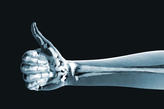 X-ray for the diagnosis of pain in the joints of the fingers