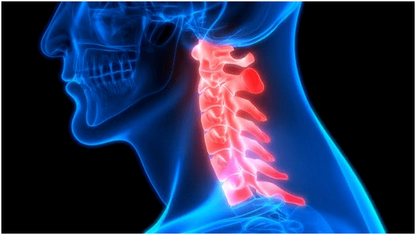 neck pain causes back pain