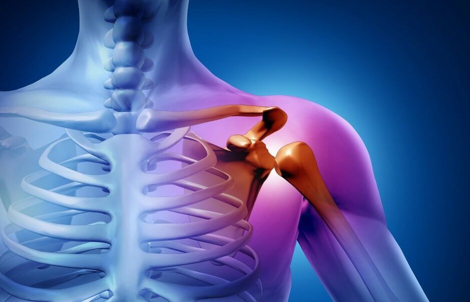 shoulder joint injury due to osteoarthritis