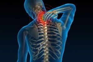 causes the pain in cervical osteocondrosis neck