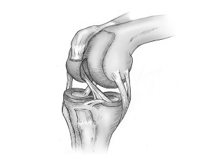 The difference between joint lesions